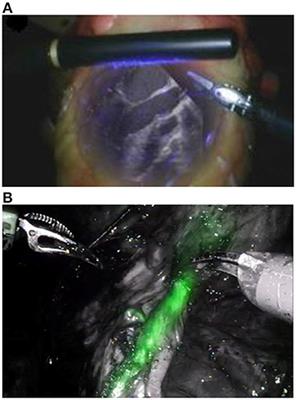 Stereoscopic Near-Infrared Fluorescence Imaging: A Proof of Concept Toward Real-Time Depth Perception in Surgical Robotics